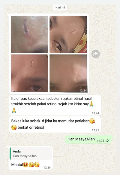 Testimoni Diahrose 4
