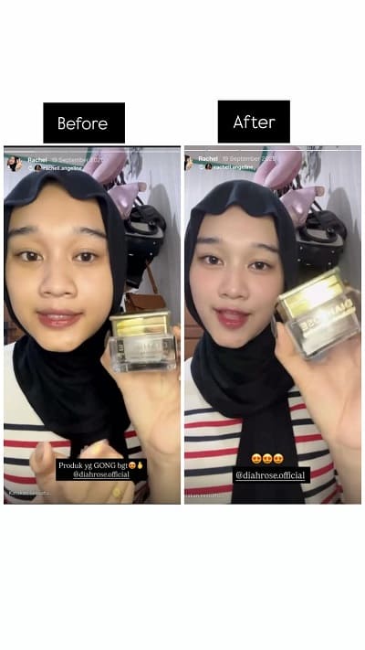 Testimoni Diahrose #23